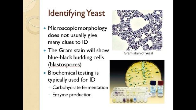 Microbes in Food Pre-Lab Lecture смотреть онлайн