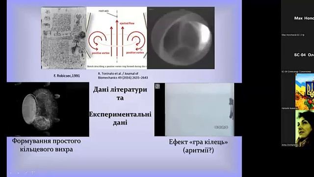 Сучасний погляд на моделювання кровообігу людини смотреть онлайн
