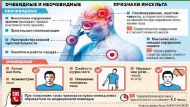 Кавинтон — На сколько улучшает память сосуды и лечит головокружение SUB— ENG смотреть онлайн