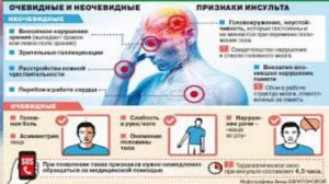 Кавинтон — На сколько улучшает память  сосуды  и лечит головокружение  SUB— ENG