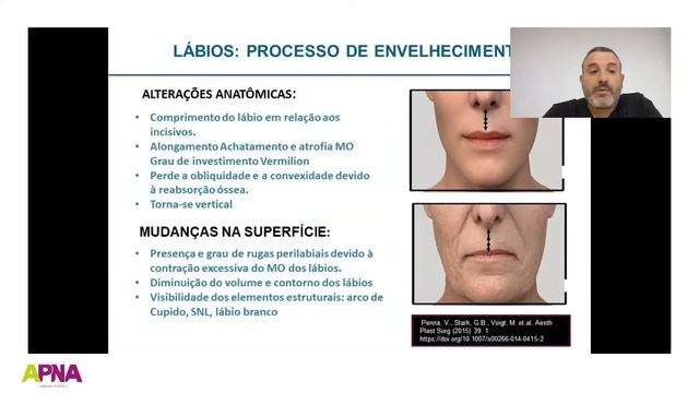 WEBINAR SOBRE O USO DO ÁCIDO HIALURÔNICO смотреть онлайн