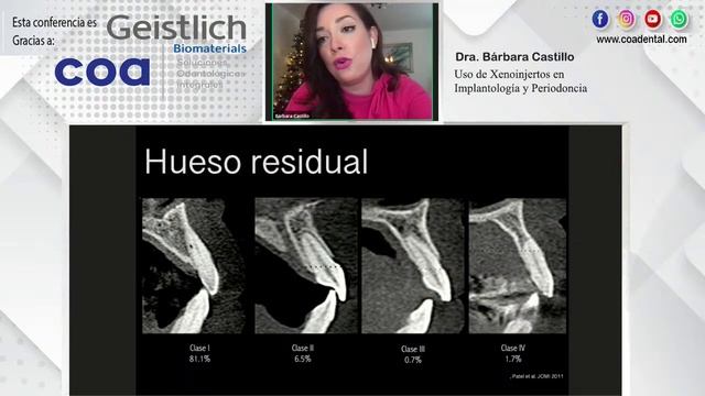 1374 Uso de Xenoinjertos en Implantología y Periodoncia смотреть онлайн