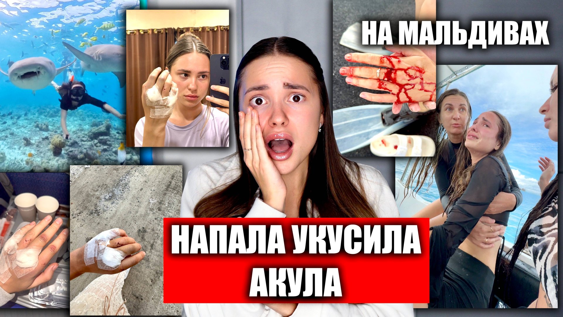 На Меня НАПАЛА и УКУСИЛА АКУЛА. СТРАШНЫЕ КАДРЫ!! Акула нянька на Мальдивах смотреть онлайн