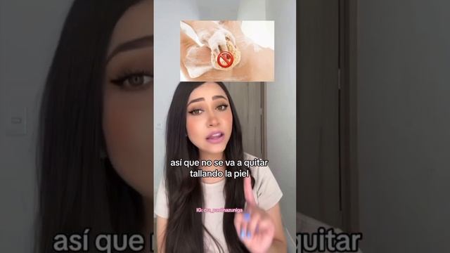 ¿Qué son estas manchitas?👩🏻⚕️ #piel #salud #dermatologia #acantosisnigricans #doctor #shorts смотреть онлайн