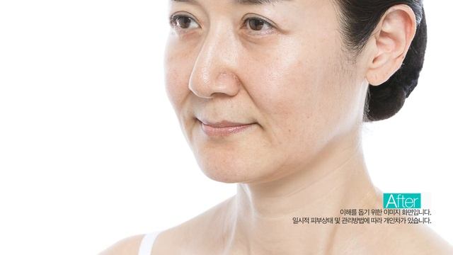 YU R Mask Before and After смотреть онлайн