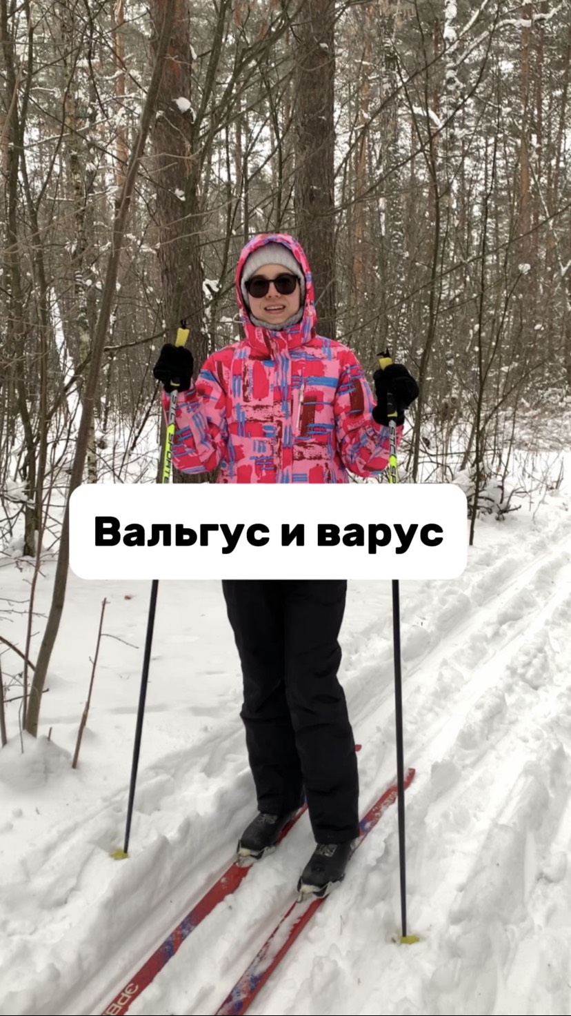 Причины деформации ног