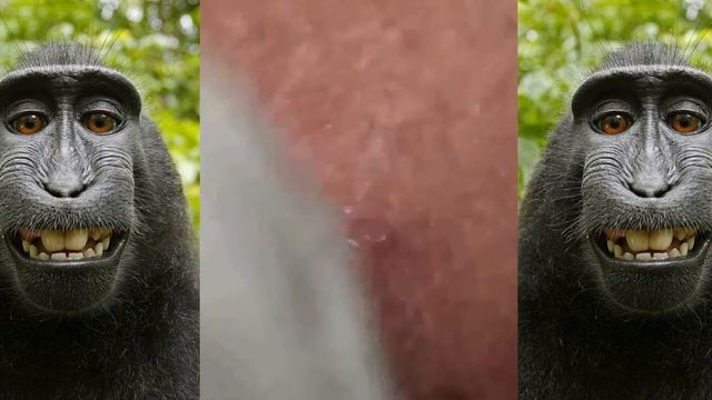 Top Pimple TV, how to remove blackheads, Part #60 смотреть онлайн