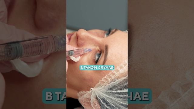 Как избавиться от мешков и провалов под глазами? #кожалица #здороваякожа #мешкиподглазами смотреть онлайн