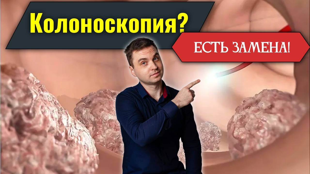 Чем заменить колоноскопию? Обследования без боли и дискомфорта смотреть онлайн