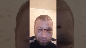 последствия сильного запоя адский отходняк