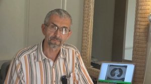 1_ Беседа врача о саркоидозе для пациентов