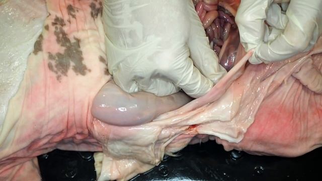 Пуповина (пупочный канатик)