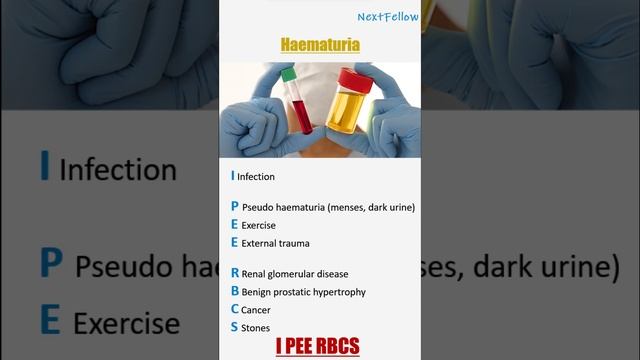 mnemonic on hematuria #mnemonics смотреть онлайн