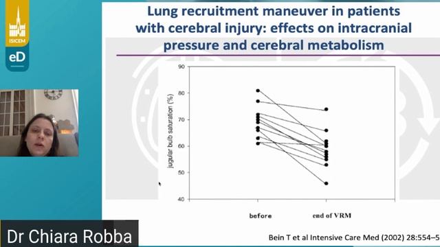 How to ventilate  brain injury C Robba  (isicem ARDS 2021)