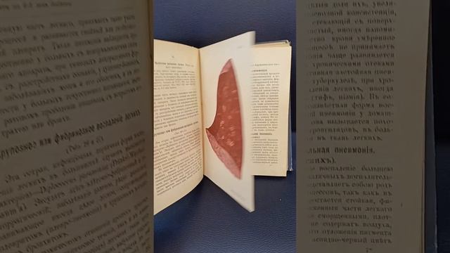 Старинный атлас патологоанатома смотреть онлайн