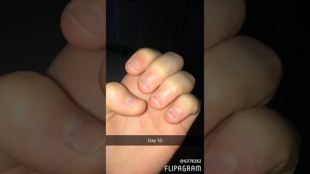 Nail growth journey 1// day 1 to 80 смотреть онлайн