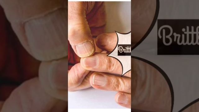 #iron#iron deficiency #doctor #sign #health #healthylife#youtubeshorts смотреть онлайн