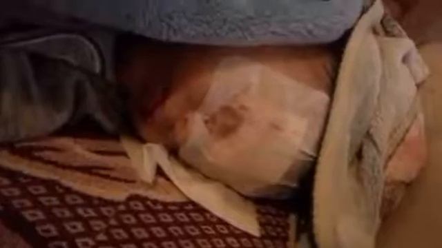 Омар после операции смотреть онлайн