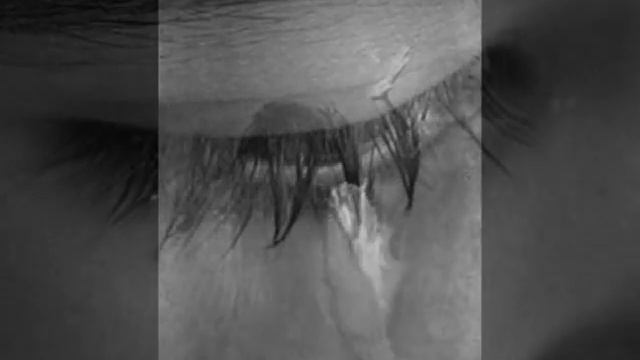 История одной болезни .wmv смотреть онлайн