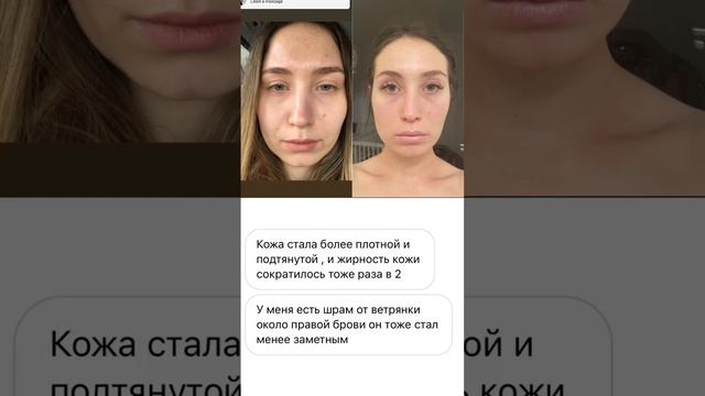 До и После смотреть онлайн