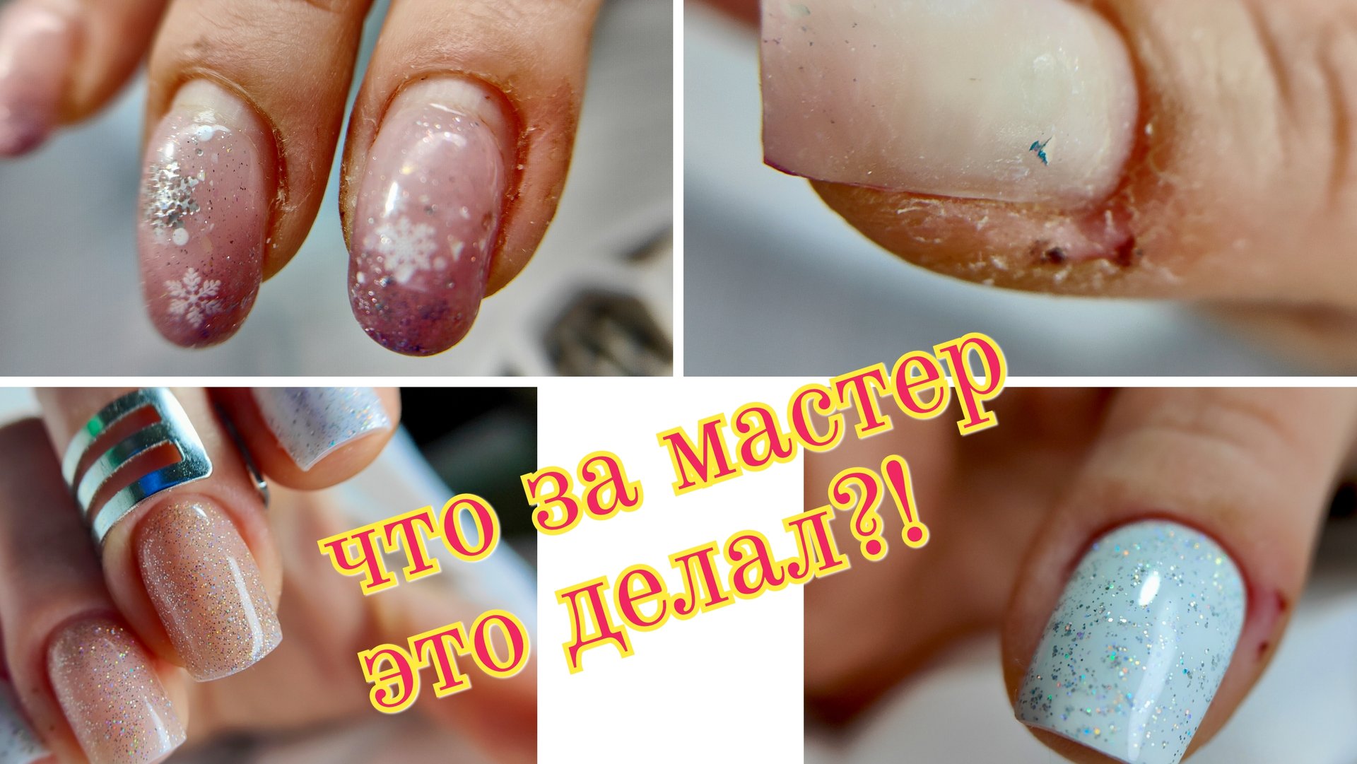 Ужасный маникюр, точек вроста нет смотреть онлайн