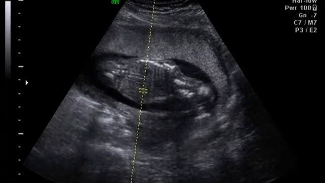 Baby Harper! Its a Girl!!! смотреть онлайн