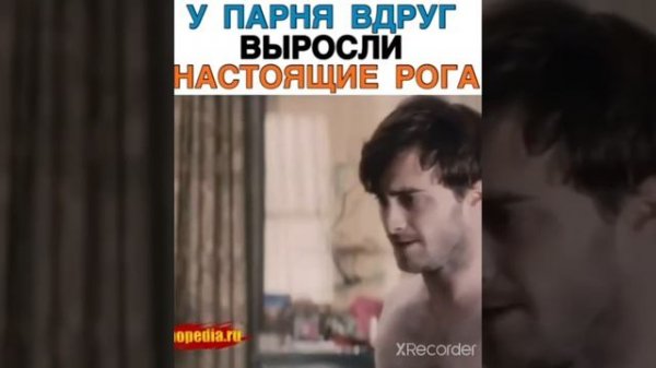 У ПАРНЯ ВЫРОСЛА НАСТОЯЩИЕ РОГА