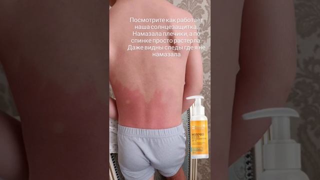 Спасёт от ожогов ‼️#сгорел #солнце #корень #сибирскоездоровье #siberianwellness #крем смотреть онлайн