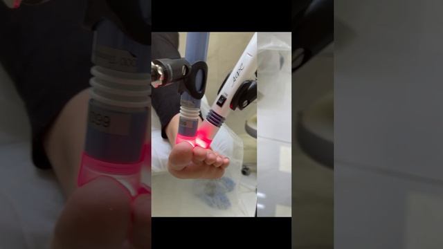 Восстановление кожи после гнойно-воспалительного процесса | Фототерапия #язва #подология смотреть онлайн