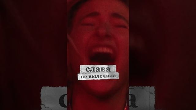 Наглая обезьяна на сцене 🙊#БытьЛучшеИсторияРоббиУильямса #новинка смотреть онлайн