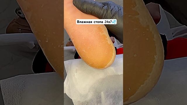 Влажная стопа - резкий запах и состояние отвращения #ноги смотреть онлайн