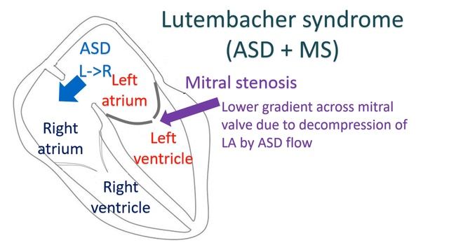 What is silent mitral stenosis? смотреть онлайн