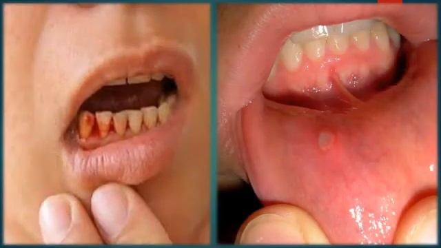 benefits of using aloe in improving immunity -how to use aloe смотреть онлайн
