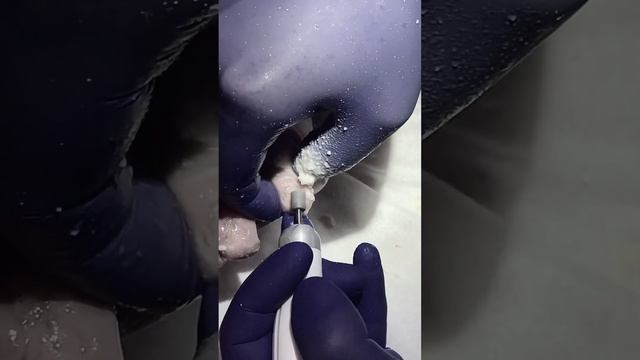 Помощь возрастным пациентам @podologmoscow #грибокногтей смотреть онлайн