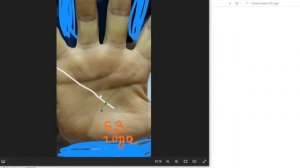 Рак печение. Онкология на руке. Знаки смерти на ладони. Линия жизни разрыв Хиромантия