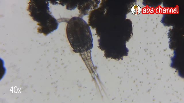 Diaptomus Plankton Spongebob