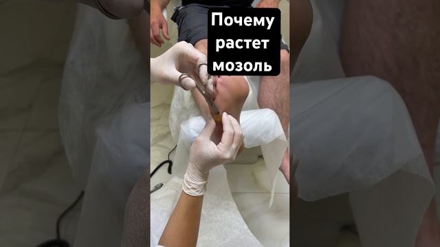 Мозольке быть всегда! | Полная версия в разделе видео на моем канале #подологтатьянапак #мозоли смотреть онлайн