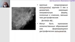 Кальцинаты в молочной железе. Лектор Колосова И.Н.