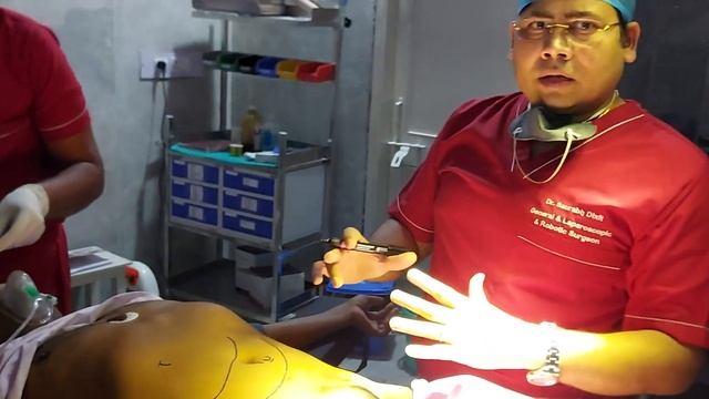 Port Placement Technique...Dr.Saurabh Dixit смотреть онлайн