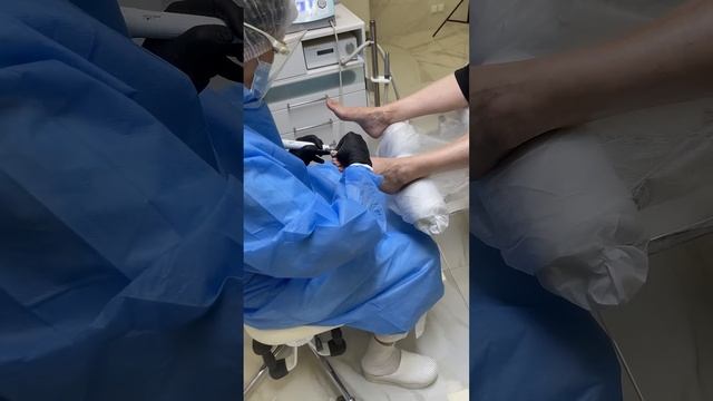 Как проходит процедура по зачистке ГРИБКА на ногтях. Больно? смотреть онлайн