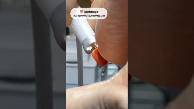 ☝️Гигиена стоп также важна как и гигиеническая чистка Зубов #медицинскийпедикюр смотреть онлайн