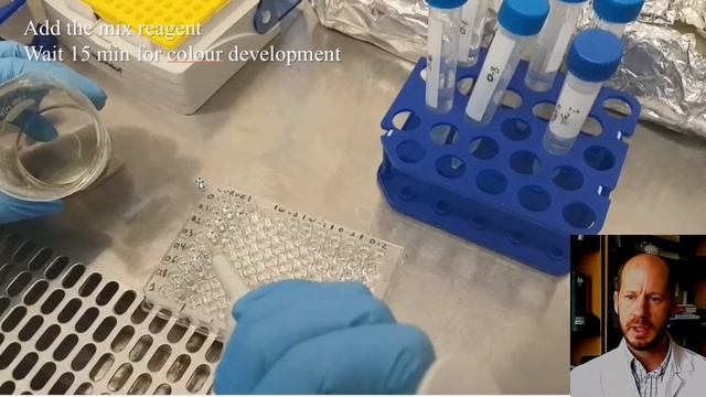 Lab 03 - Measuring soil phosphorus bioavailability - Olsen P and water extractable P смотреть онлайн