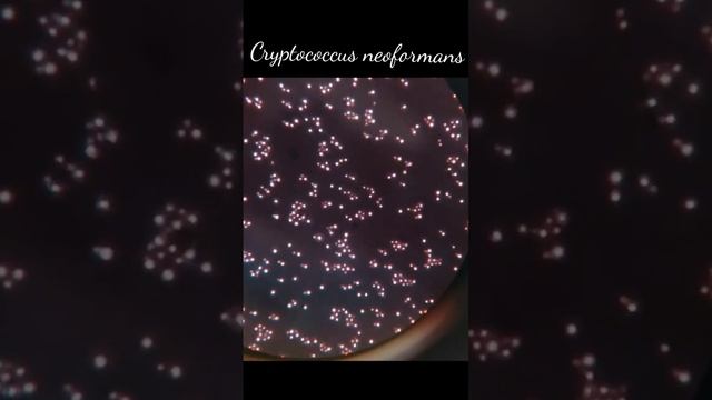 Meningitis fungus | Cryptococcus neoformans | #bscmlt #bscnursing смотреть онлайн