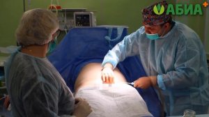 Операции по удлинению и утолщению полового члена