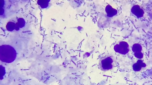 урогенітальний мазок #мазокНаФлору