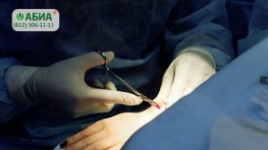 Удаление гигромы кисти в клинике "АБИА"