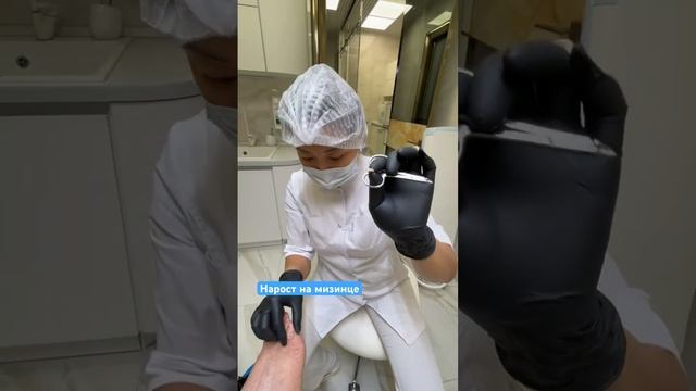 Болит что-то твердое на мизинце #мозоли #удалениемозоли смотреть онлайн