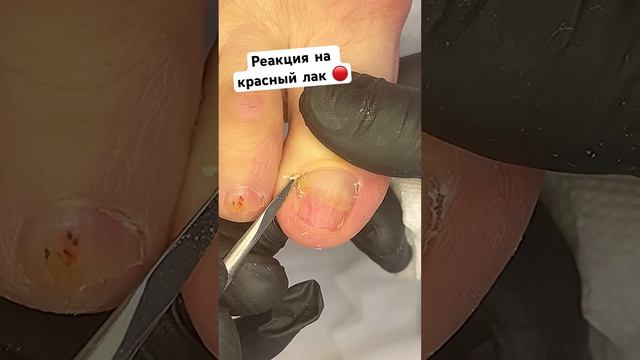 Стоп ✋ КРАСНЫЙ #подологтатьянапак смотреть онлайн