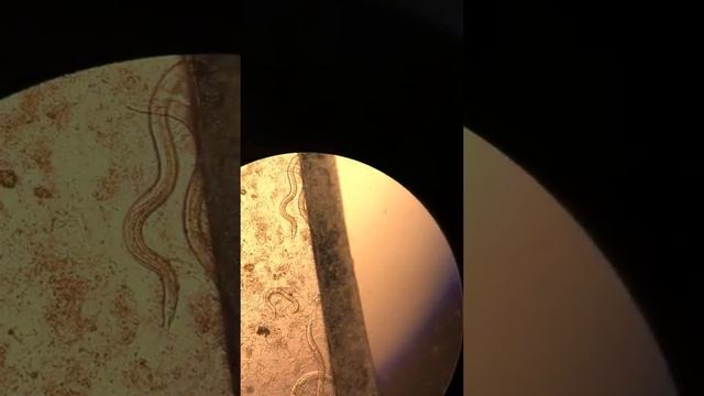 Strongyloides stercoralis смотреть онлайн