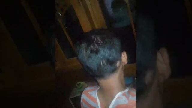 Rambut Rontok Parah, Badan Kurus, Sembuh Dari Sakit Maag Kronis, Asam Lambung, Gerd, Dan Anxiety смотреть онлайн